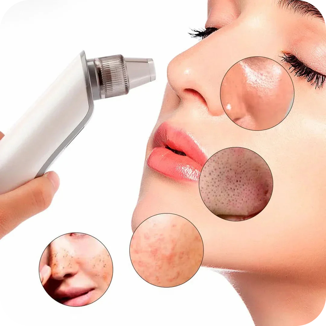 Removedor de Puntos Negros ClearPlex | Blumin