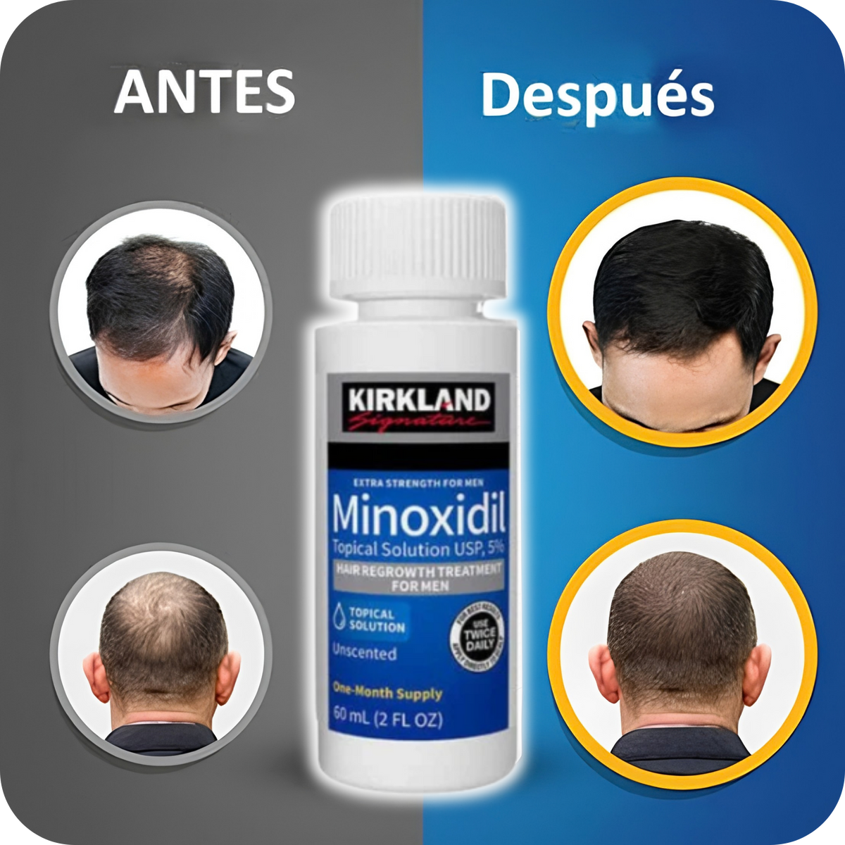 Minoxidil Kirkland Signature