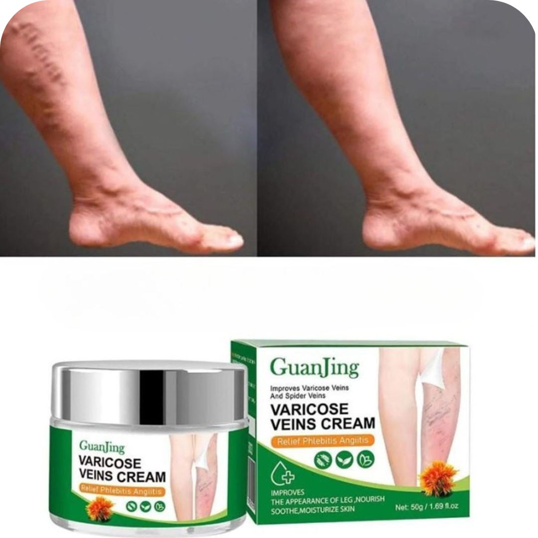 Crema para Várices y Piernas Cansadas | VeinRelief®