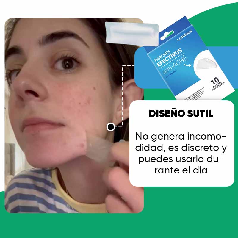 Pack de 10 Parches Anti-Acné Rectangulares | Luminex