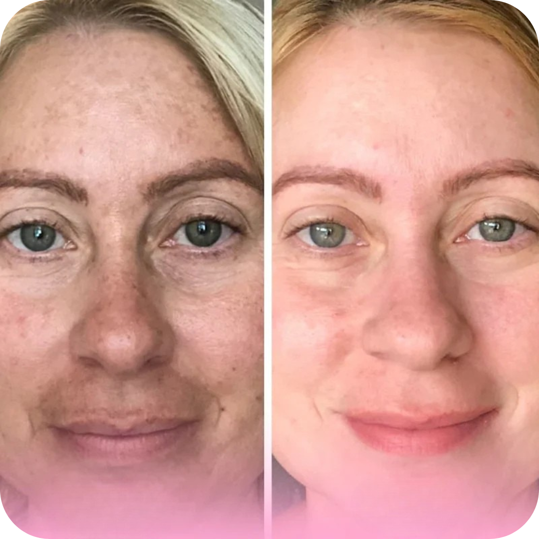 Almohadillas Limpiadoras y Exfoliantes para Rostro | SkinPads