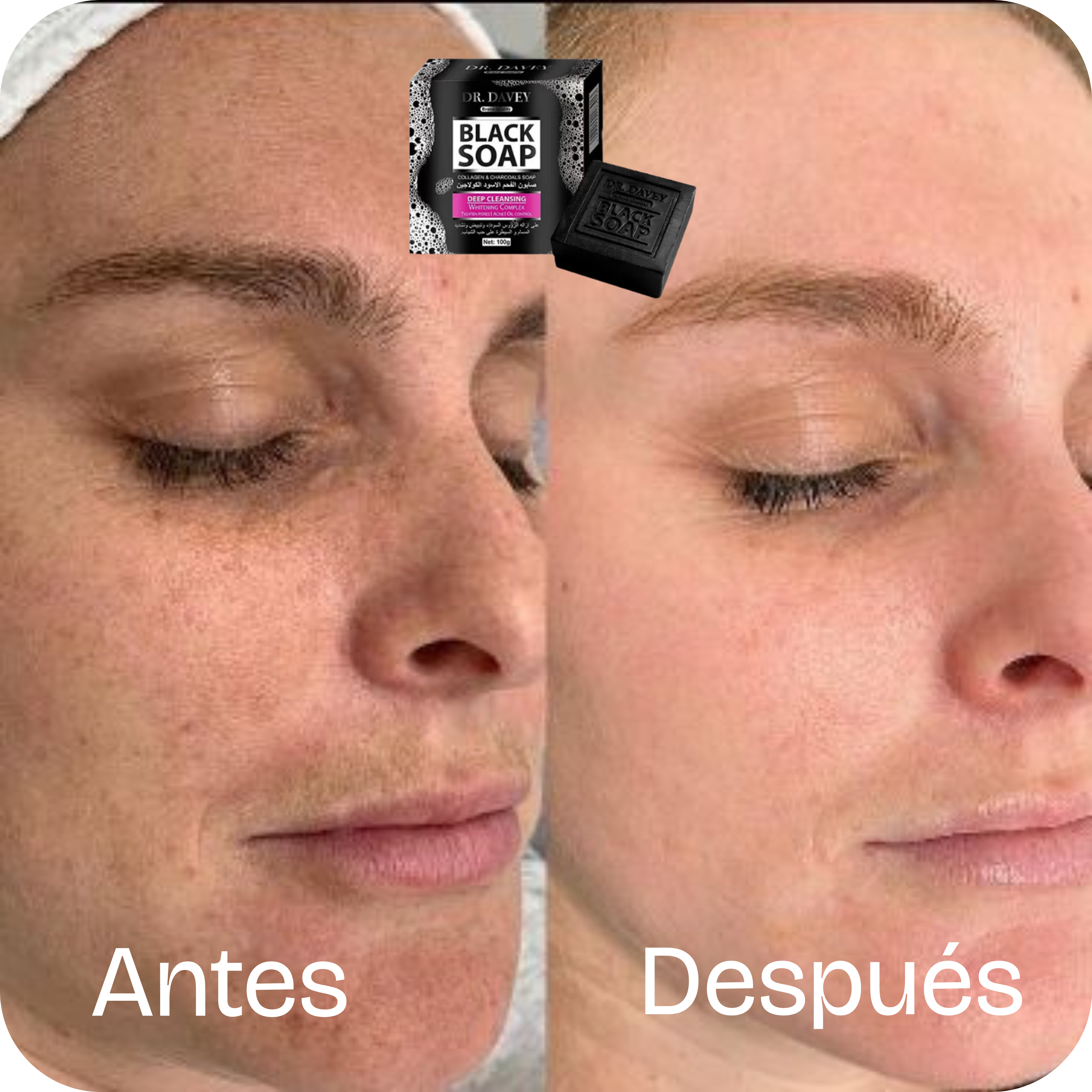 Jabón Facial de Carbón Activado Limpieza Profunda | CharcoalPure