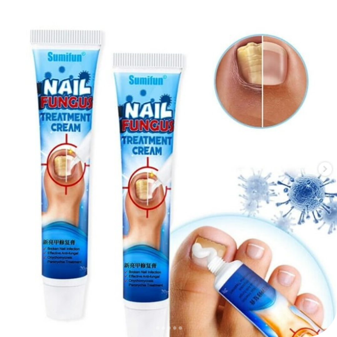 Crema Anti Hongos para los Pies | NailFungus®