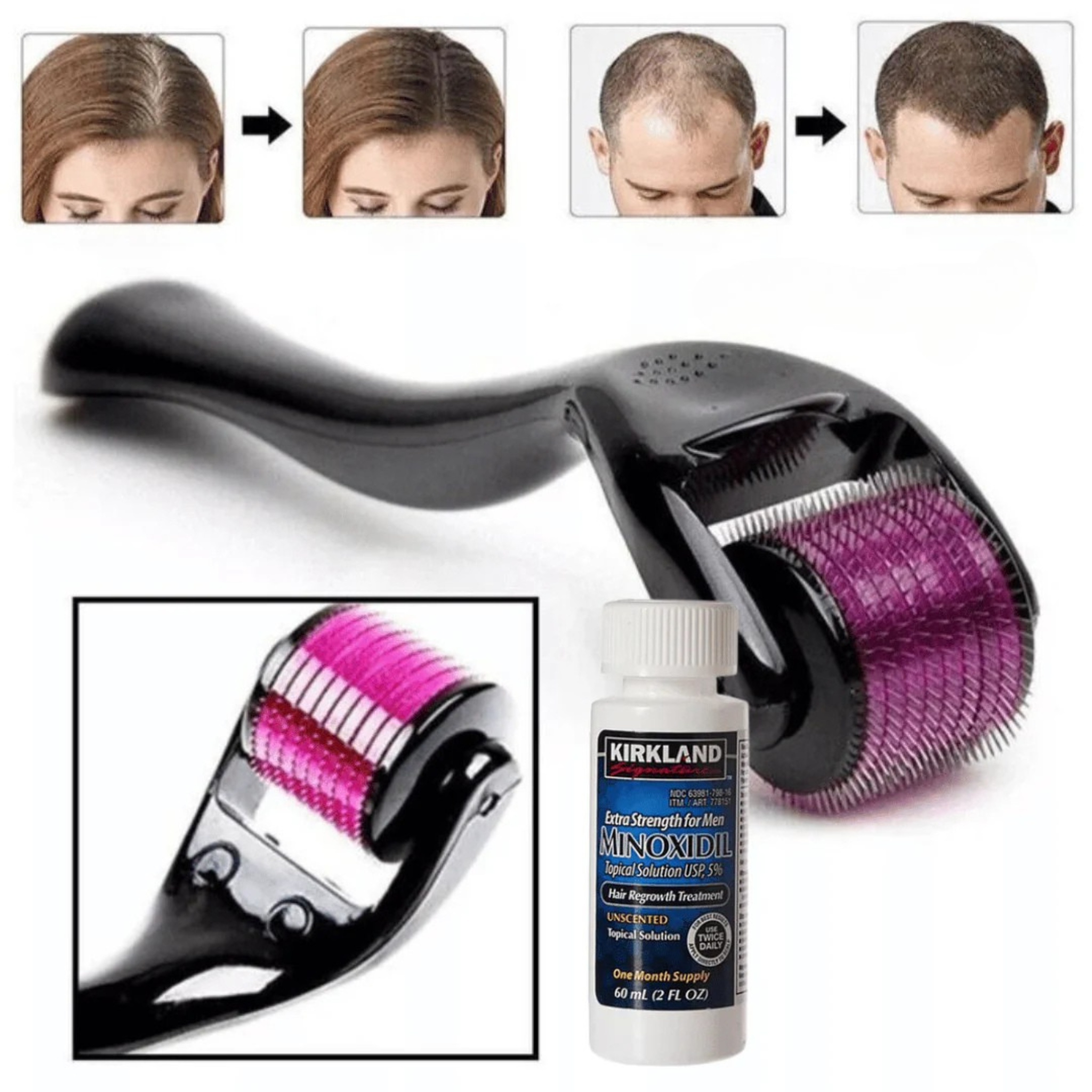 Tratamiento para Barba y Cabello + Derma Roller de Regalo | MinoxiMen