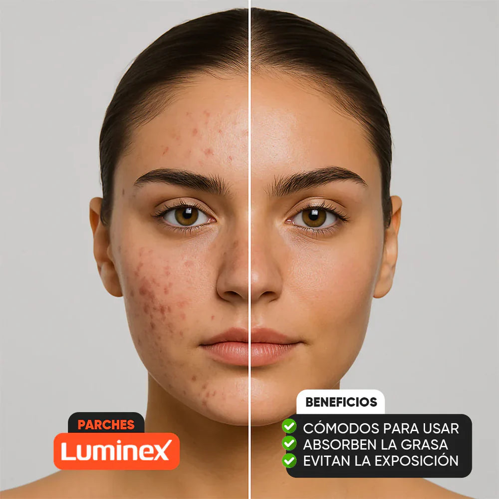 Pack de 48 Parches Anti-Acne Circulares | Luminex