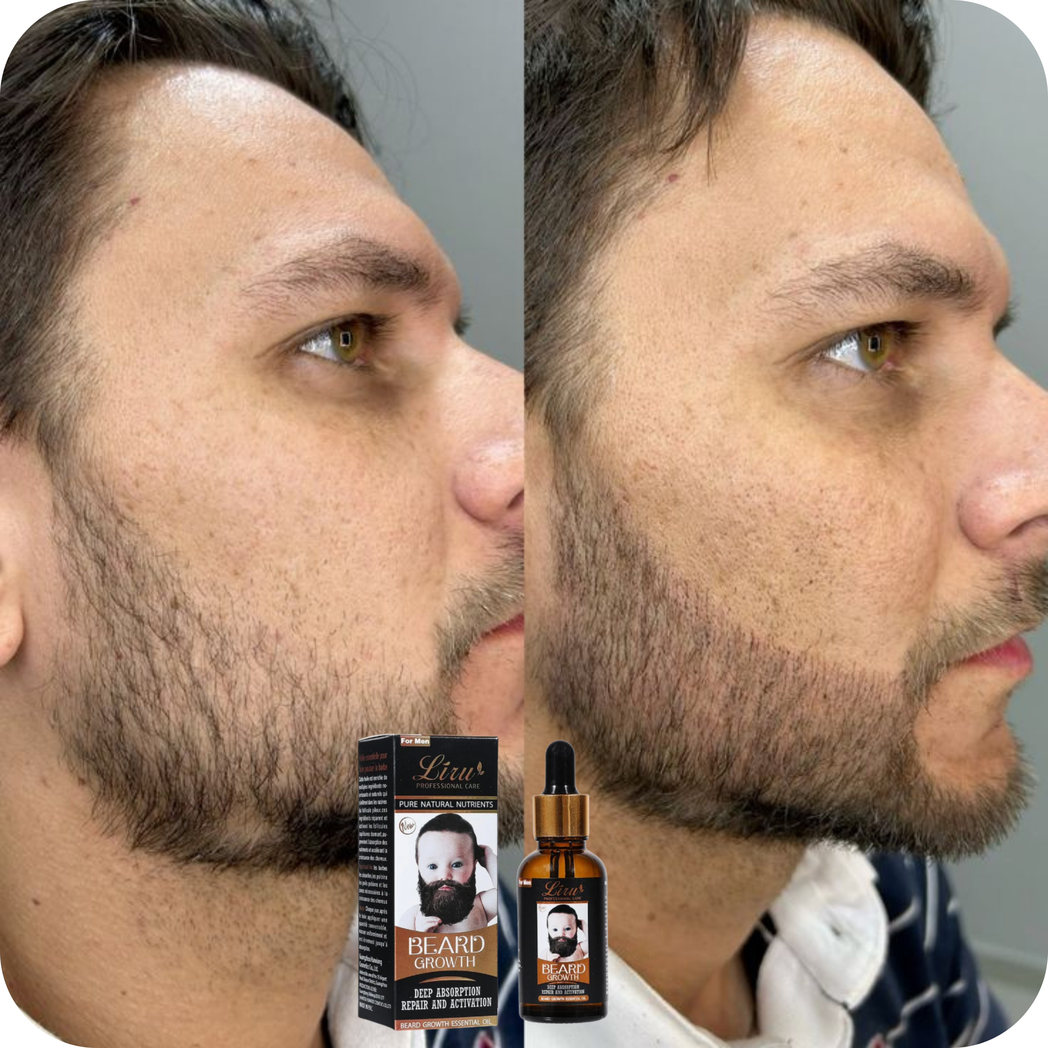 Aceite Hidratante para Crecimiento y Fortalecimiento de Barba | BeardBoost