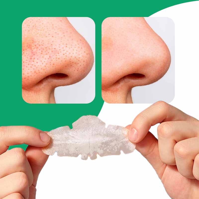 Pack de 10 Parches Anti-Acné para Nariz | Luminex