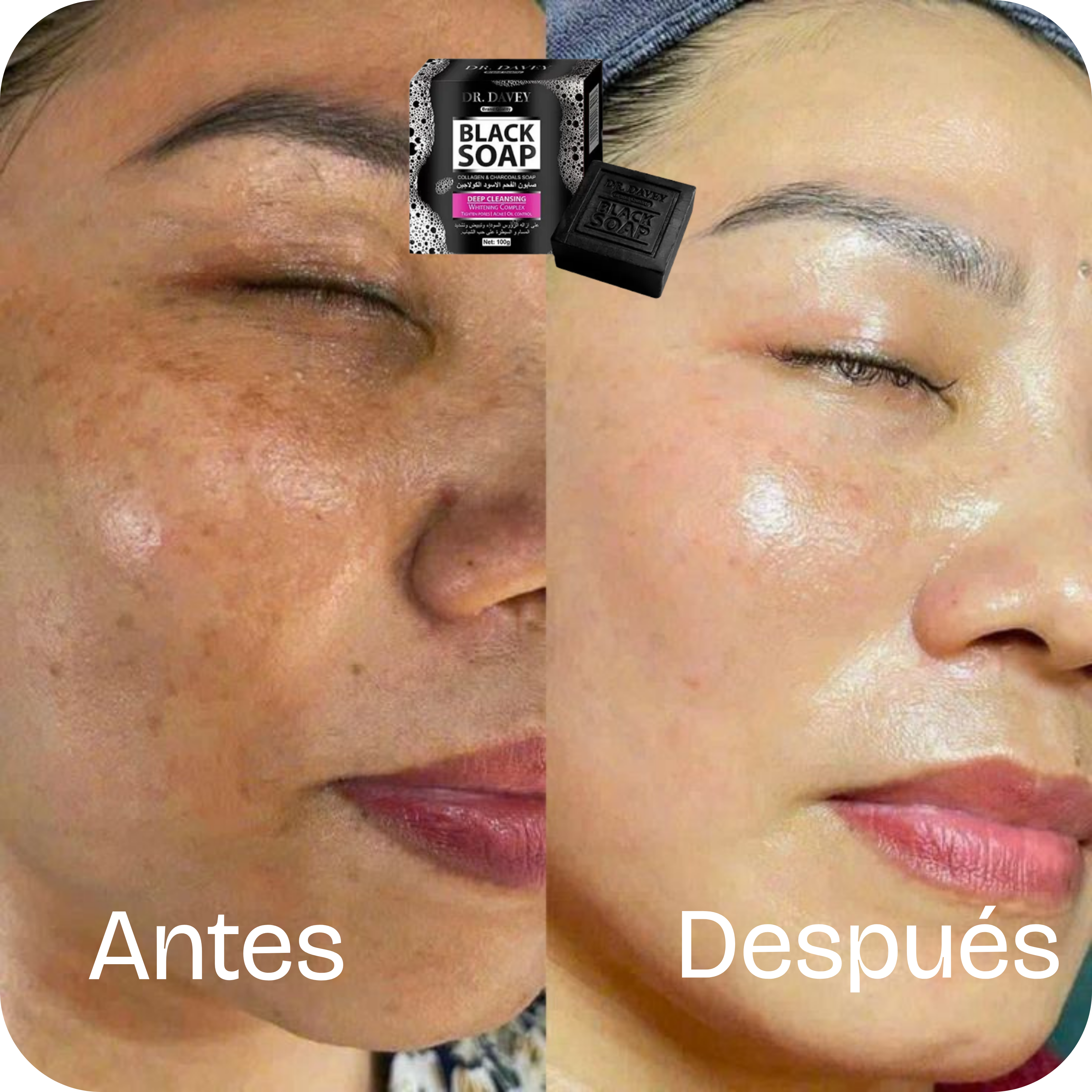 Jabón Facial de Carbón Activado Limpieza Profunda | CharcoalPure