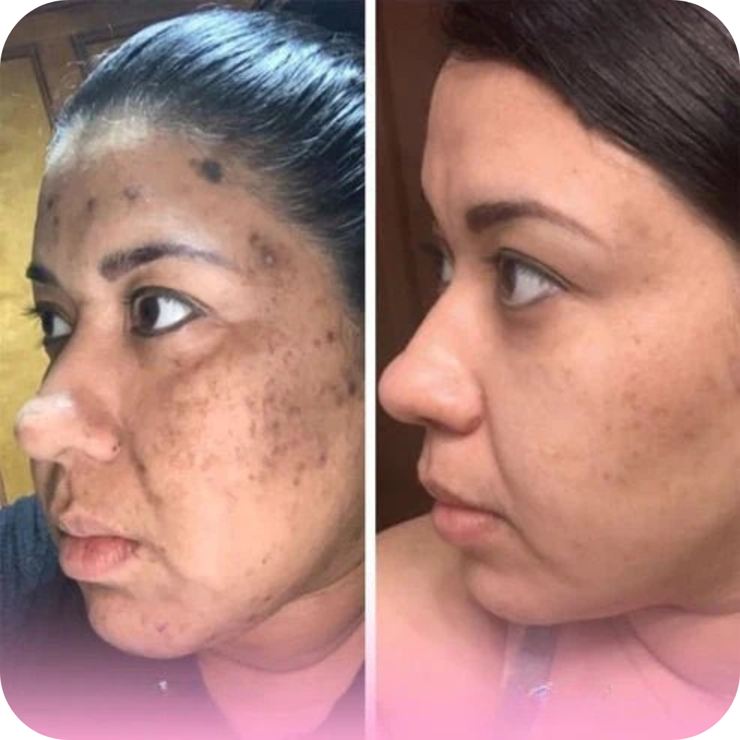 Almohadillas Limpiadoras y Exfoliantes para Rostro | SkinPads