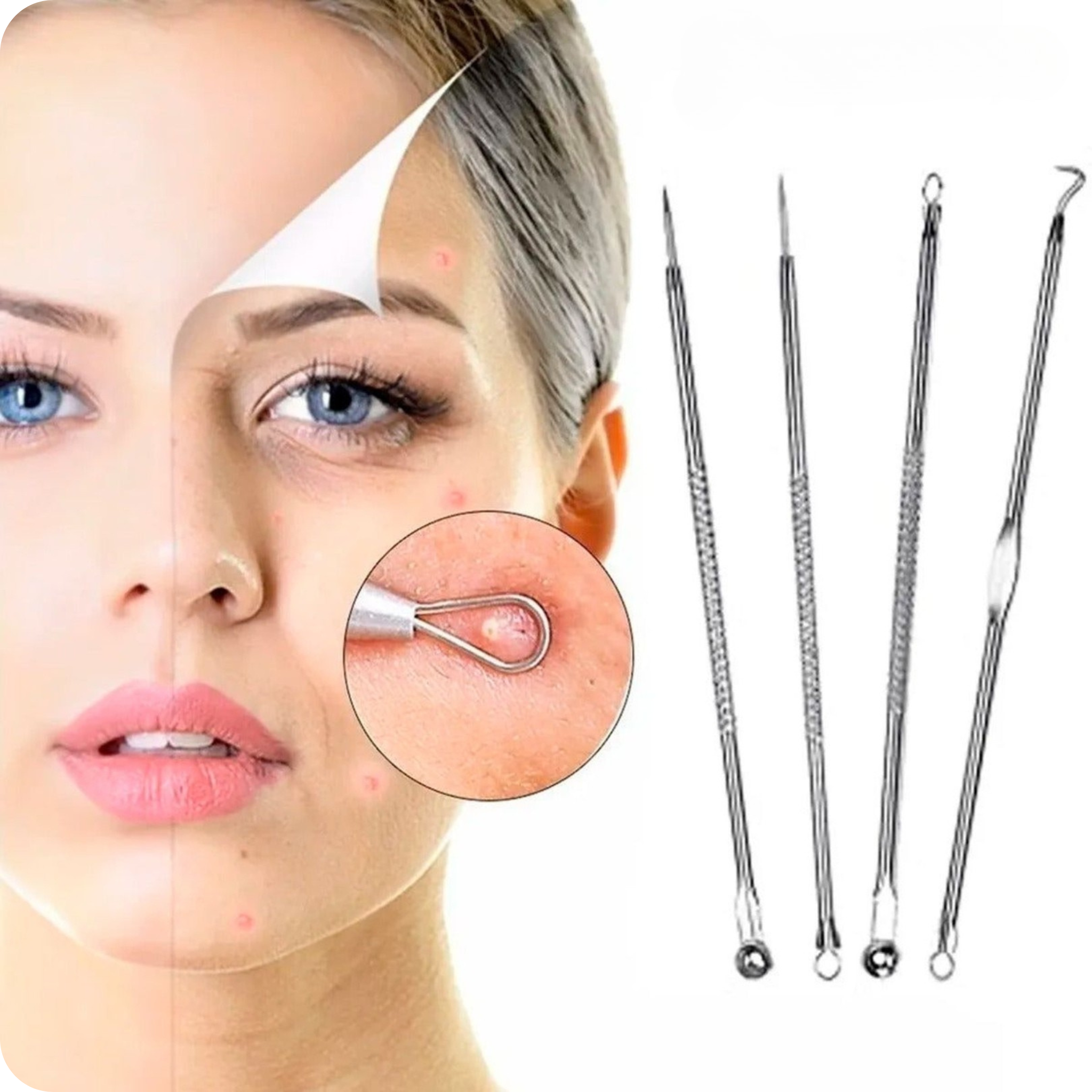 Kit De 4 Extractores De Puntos Negros | DermaClear®